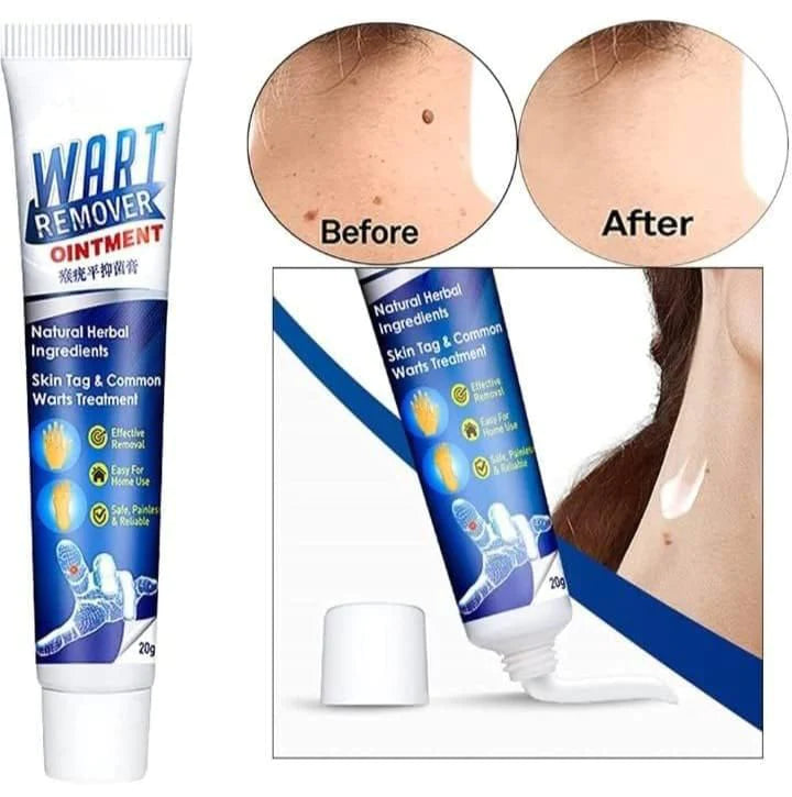 Wart Remover Instant Blemish Removal Cream